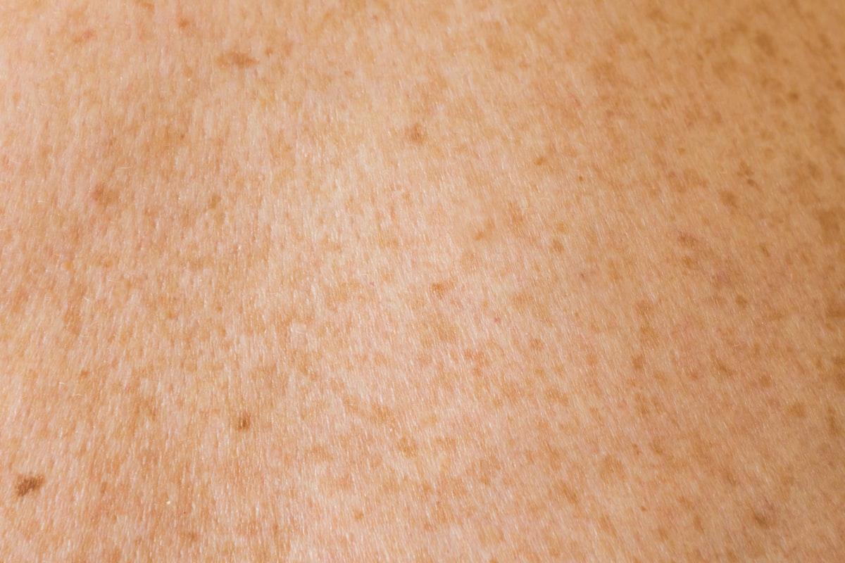 Nutritious foods for skin health